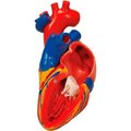 Fabrication Enterprises 3B® Anatomical Model - Heart with Bypass, 2-Part 974804